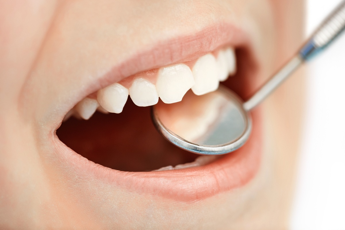 Реставрация зубов композитными пломбами | Стоматология в Химках | Стоматология Кантри Парк