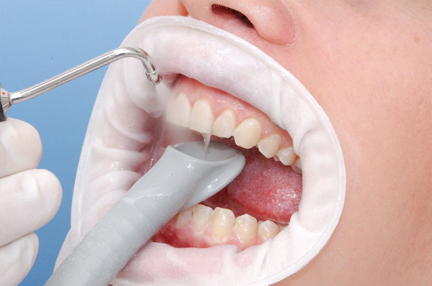 Профессиональная гигиена полости рта | Стоматология в Химках | Стоматология Кантри Парк