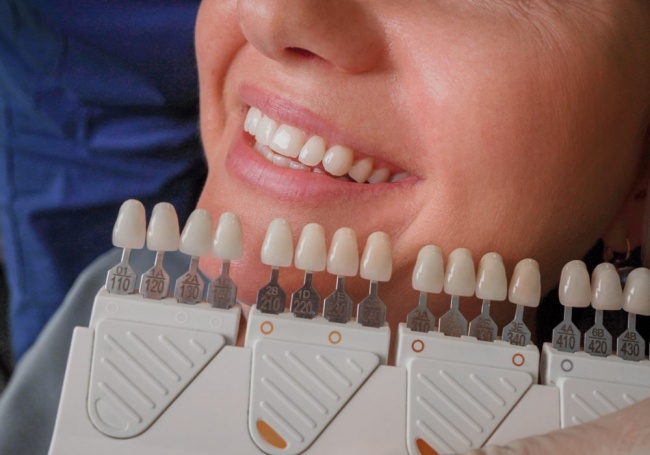 Отбеливание зубов Air Flow | Стоматология в Химках | Стоматология Кантри Парк