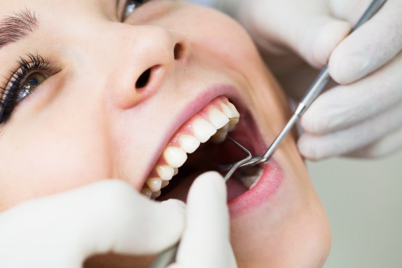  Лечение кариеса зубов